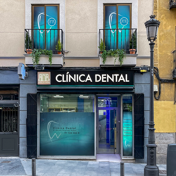 Férulas de descarga - Clínica Dental Puerta de Toledo