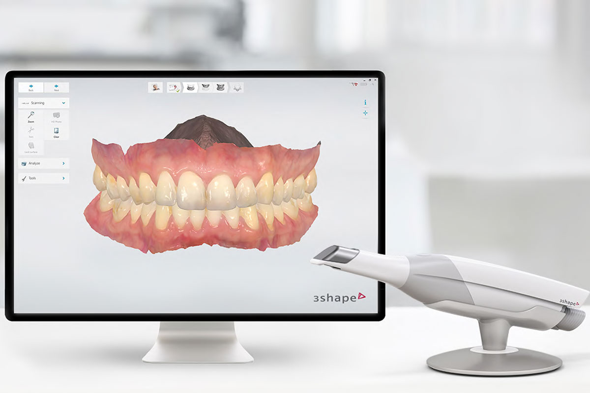 dientes-Escaner-Intraoral-Trios-3Shape-dental-madrid.jpg