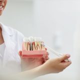 Implantes dentales con injerto óseo