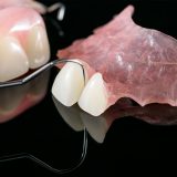Cómo cuidar tu prótesis dental