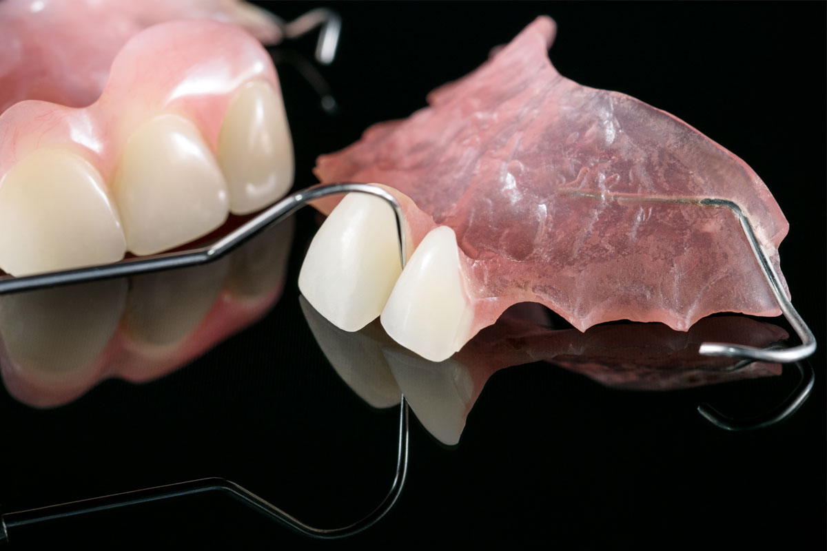 protesis-dental-madrid-dentista-23.jpg
