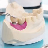 Implantes dentales sin hueso