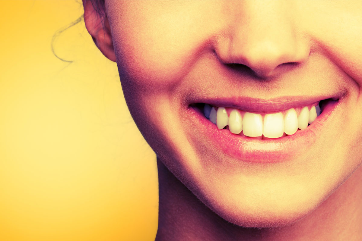 dientes-amarillos-dental-madrid-dentista-2025.jpg